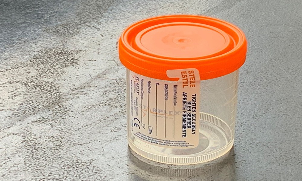 Understanding Ingredients Commonly Included Within Synthetic Urine Kits Today