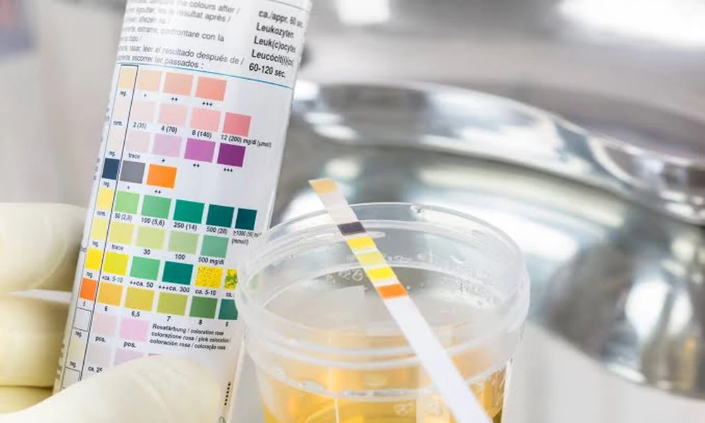 Connecting Health Knowledge with Everyday Decisions Through Reliable Urine Testing Information